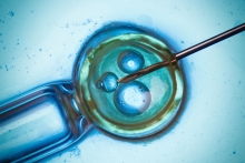 IVF procedure lab close-up